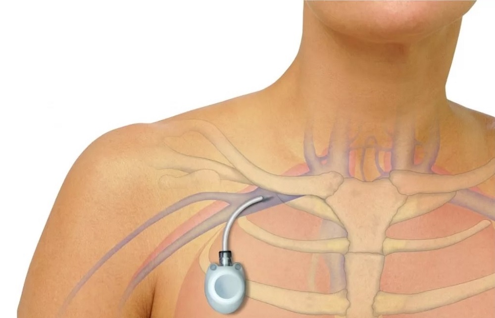 Что такое порт-система