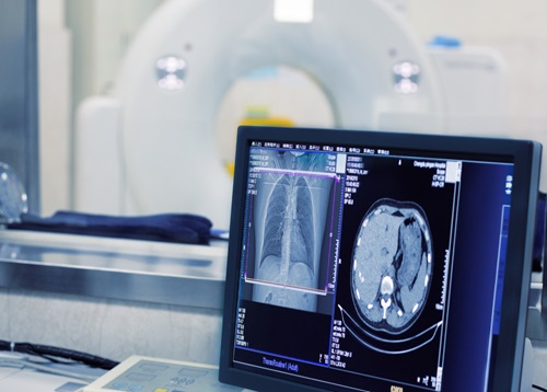 Расшифровка результатов КТ сердца и коронарных артерий у кардиолога