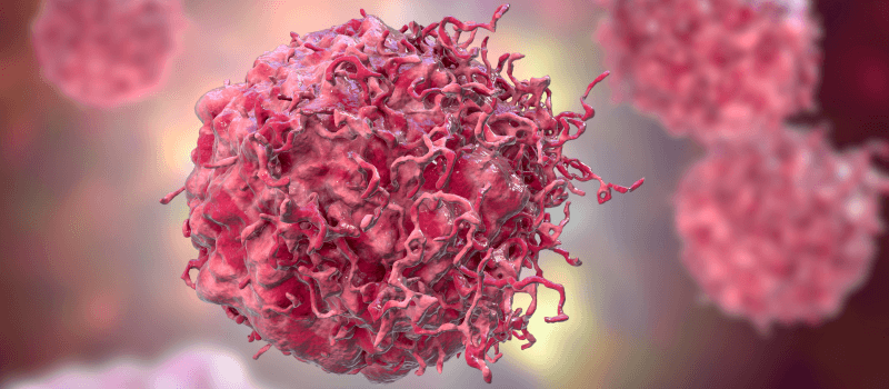 новообразование