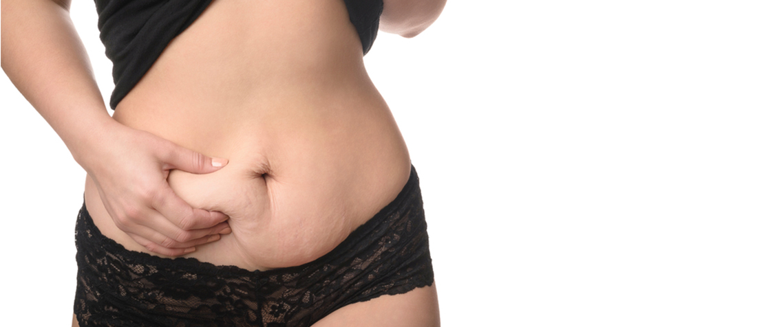 восстановление после похудения