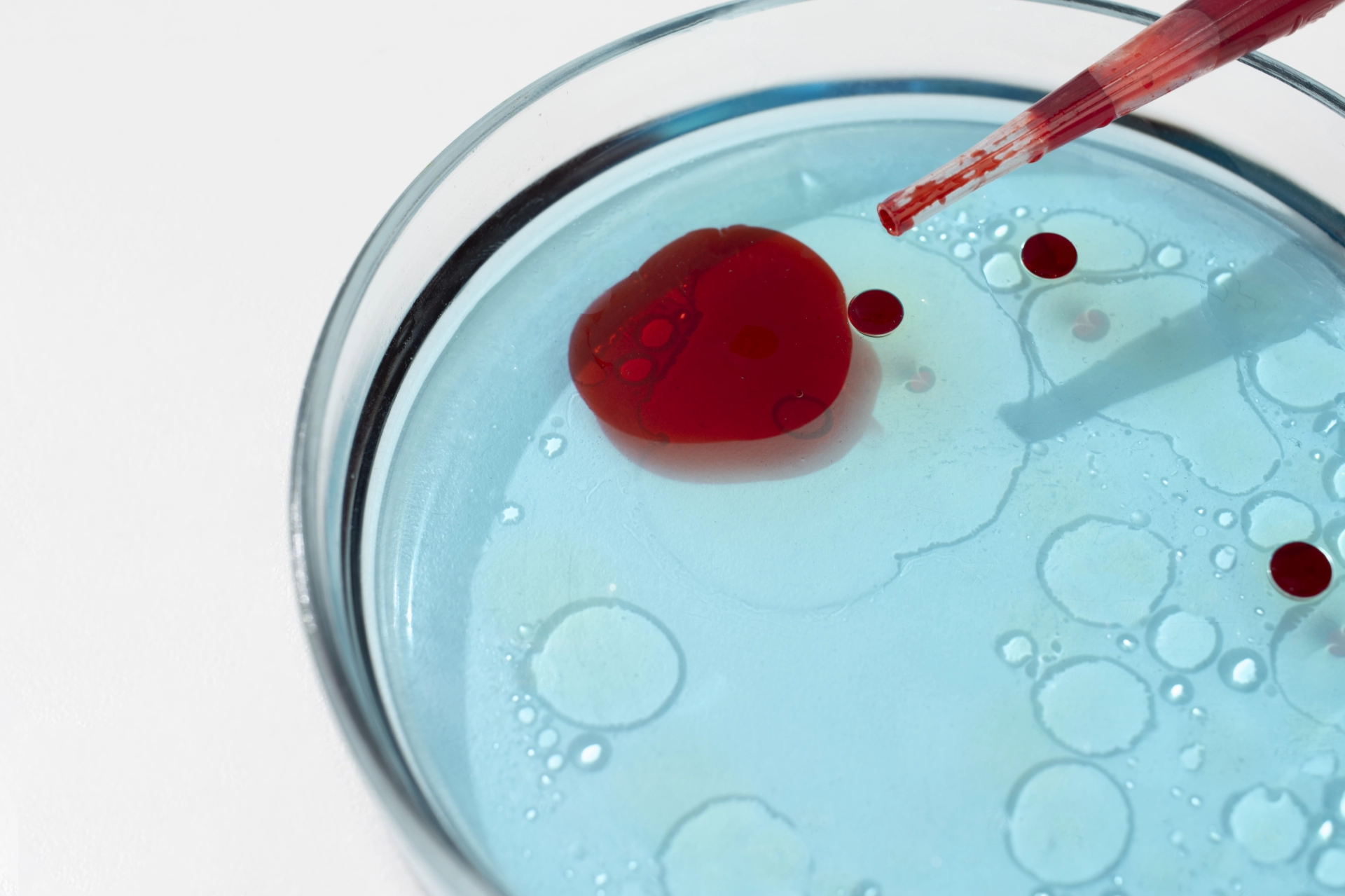 Что такое коагулограмма