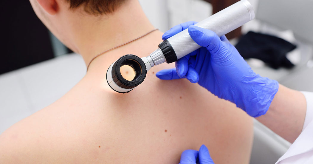 что такое дерматоскопия