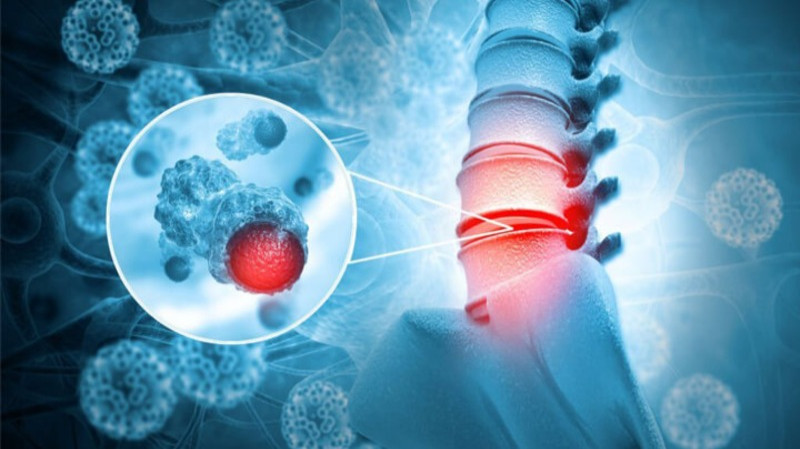 Причины саркомы