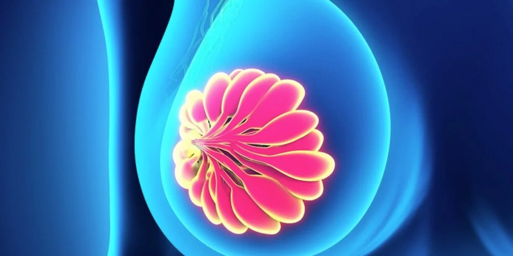 что такое мастит