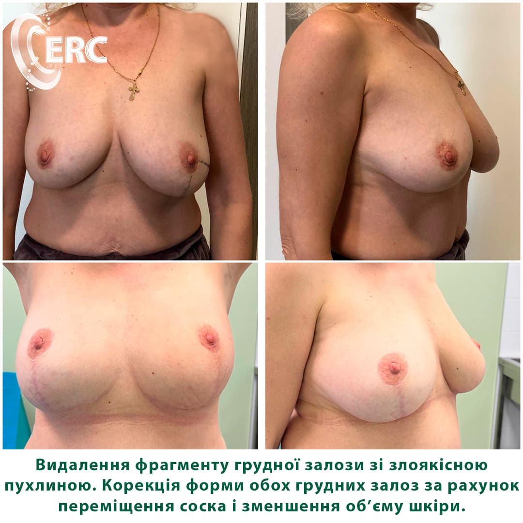мемопластика