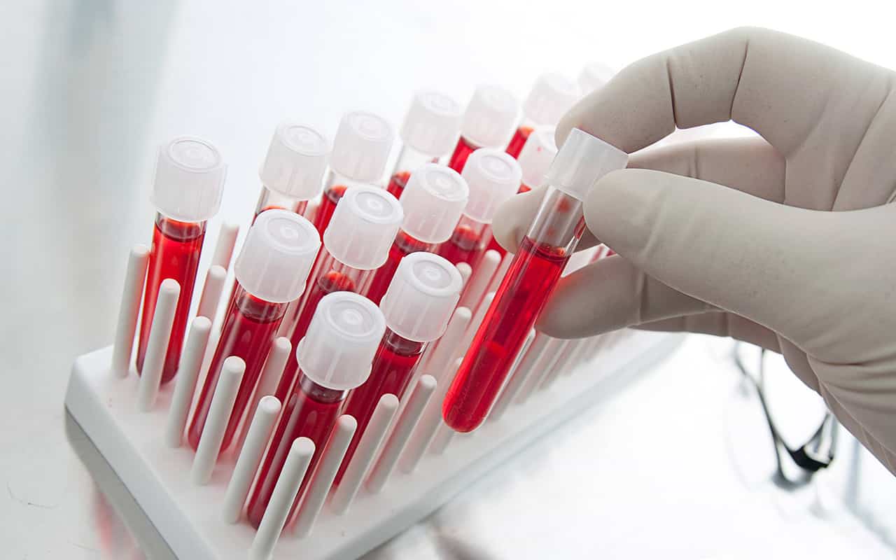 Образцы венозной крови для анализа на гормоны